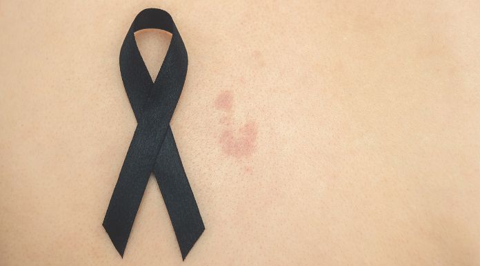 Clare Cancer Survivor Says Vaccine Will Offer ‘Less Fear And More Hope’ For Patients